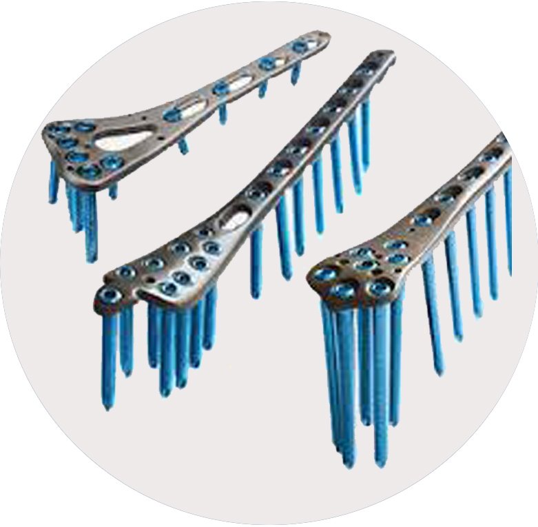 Orthopaedic Implants
